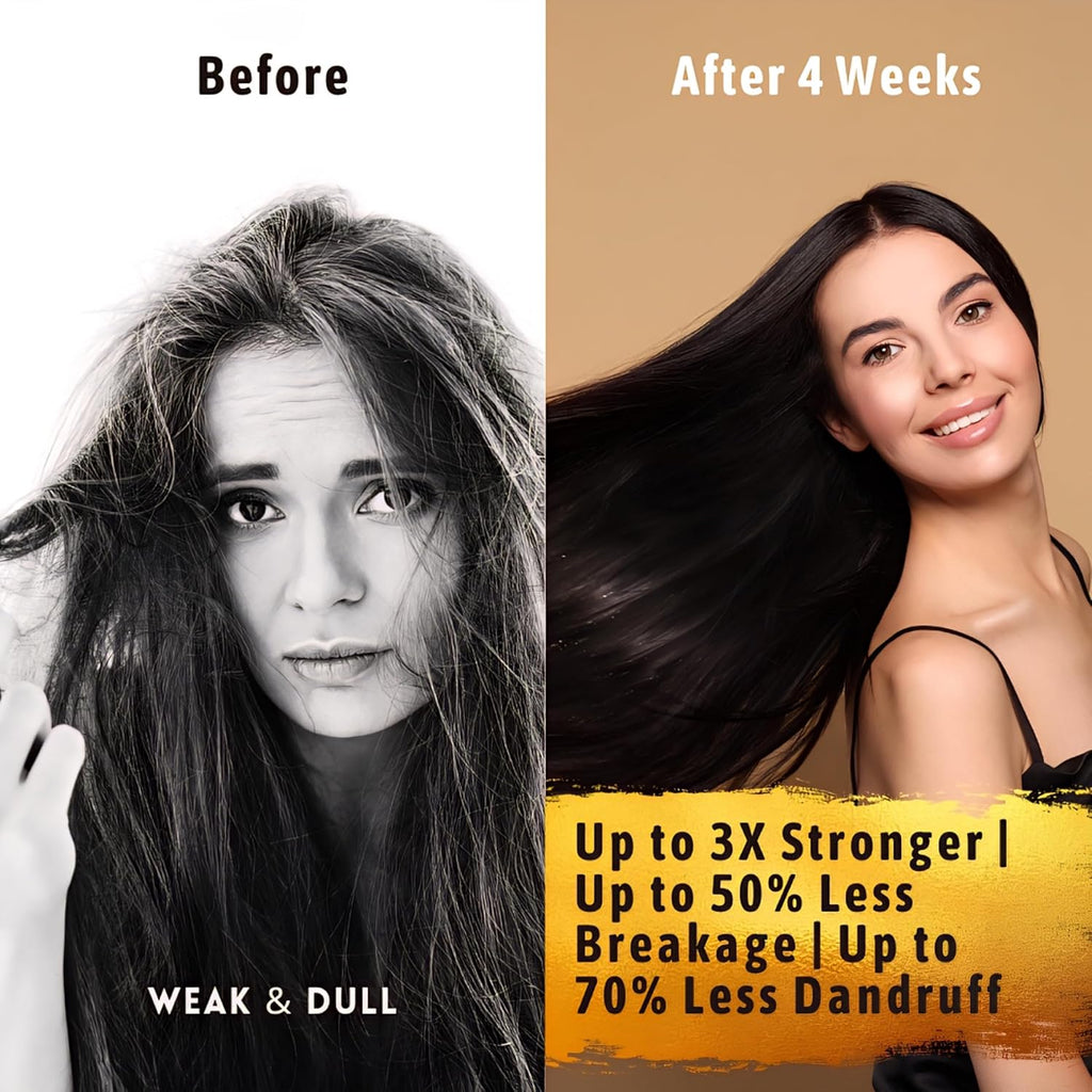 Hair Growth Serum Women & Men — USDA Organic Natural Scalp Serum (30 ml) | Tricho10™ with 10 Botanical Oils for Reduced Shedding, Improved Hair Density & Visible Hair Growth in 90 Days(All Hair Types)