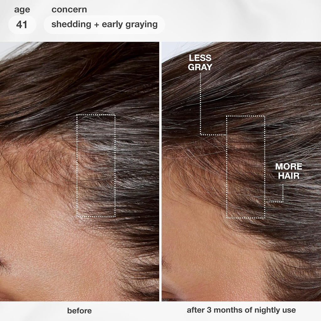 K18 FutureIQ Biomimetic Longevity Hair + Scalp Serum, 3.04 oz